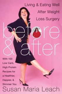 Before & After: Living & Eating Well After Weight Loss Surgery