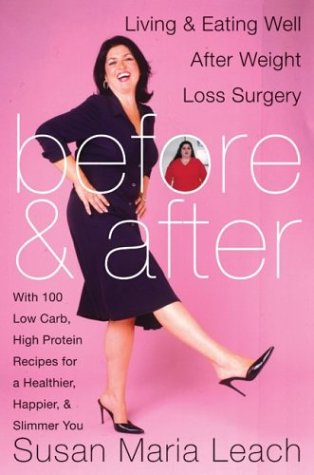 Before & After: Living & Eating Well After Weight Loss Surgery