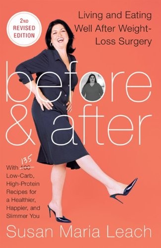 Before & After, Second: Living and Eating Well After Weight-Loss Surgery